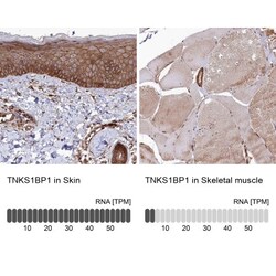 Tankyrase binding protein 1 Antibody, Novus Biologicals 0.1mL; Unlabeled:Antibodies,